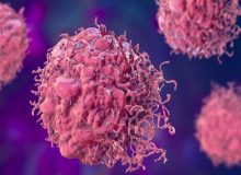 وضعیت شیوع یک سرطان زنانه در ایران/احتمال ورود واکسن HPV به برنامه واکسیناسیون ملی